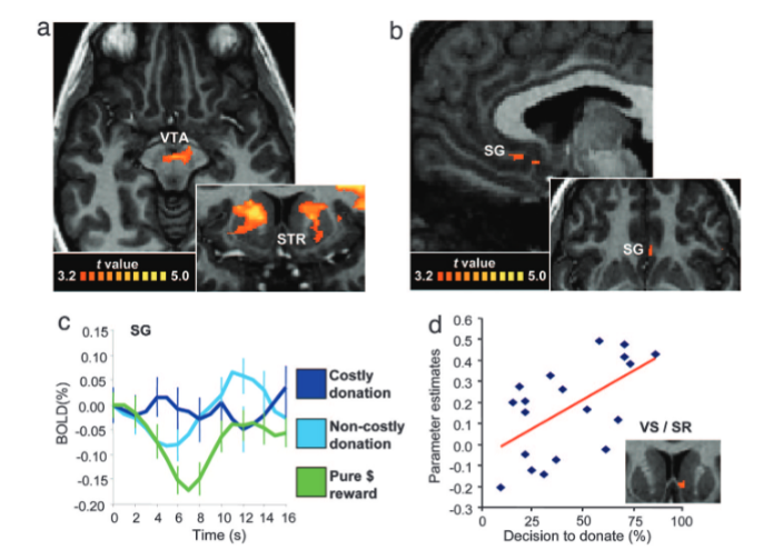 MRI images showing human brain when giving